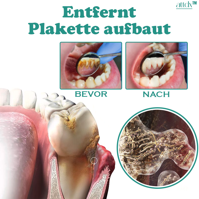 ATTDX 360° Frische Nebel Tiefenreinigendes Mundwasser