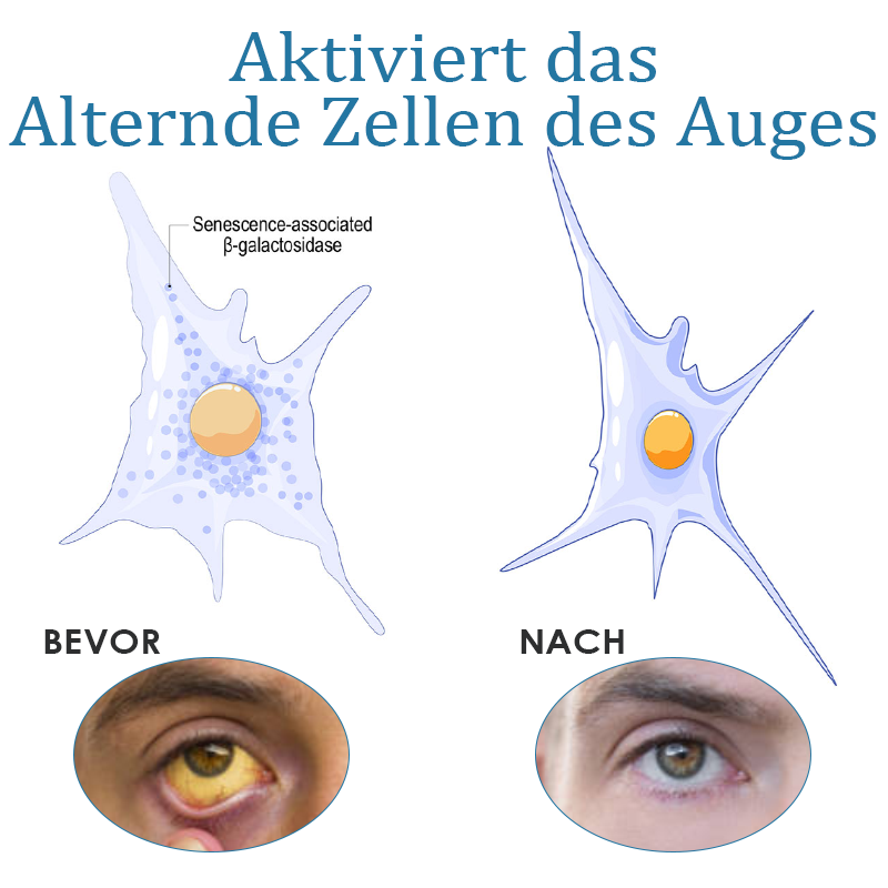 ATTDX Behandlung von Augenproblemen Umkehr Augentropfen