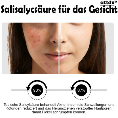 ATTDX Hautunreinheit Akne Jugend Serum