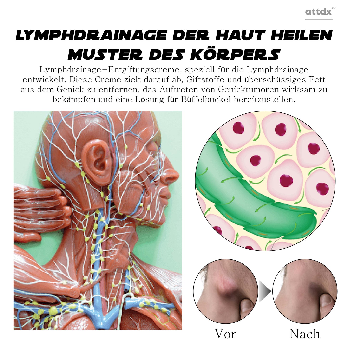 ATTDX Lymphknoten BildhauerischeEntwässerung Entgiftungscreme