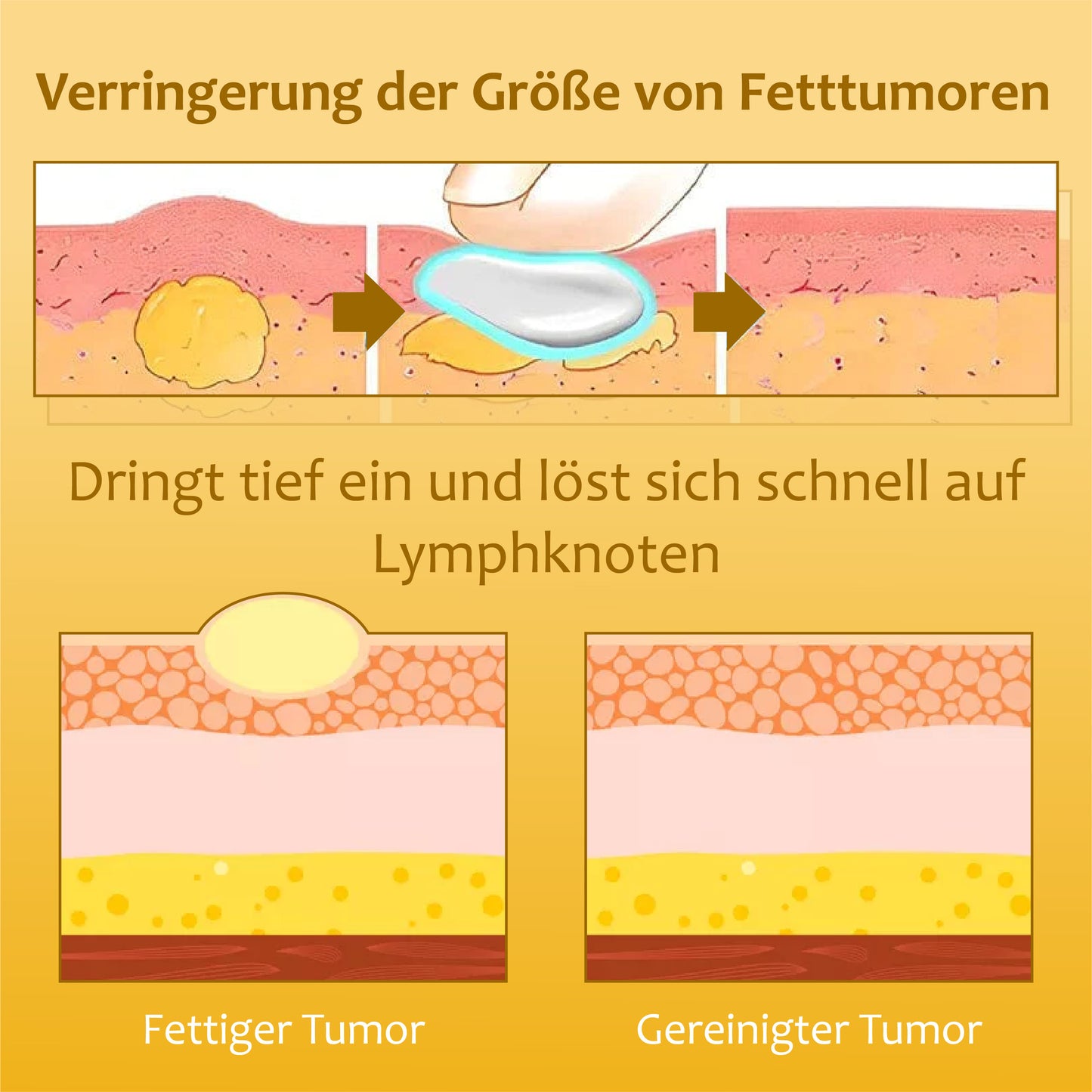 ATTDX Lymphatisches Ingwer LinderungsCreme