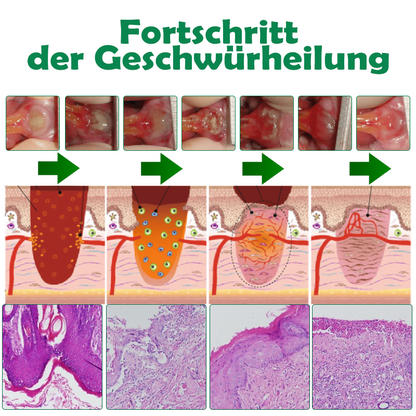 ATTDX Mundpflege Propolis GeschwürErleichterung Sprühen