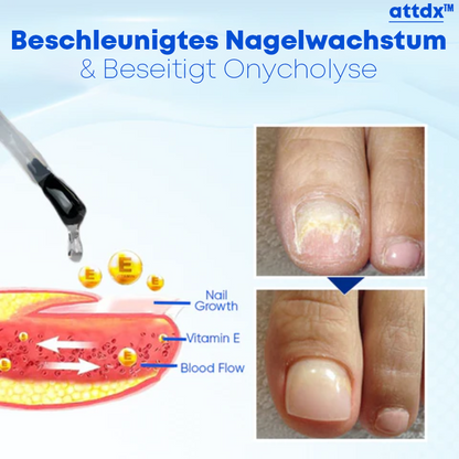 ATTDX Nagelerneuerungs Restaurierungs Serum