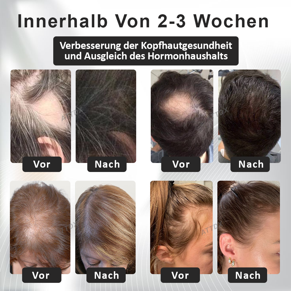 ATTDX™ Alopecia Wiederherstellungs Haar Booster Roll-On