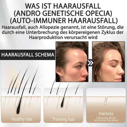 ATTDX™ Alopecia Wiederherstellungs Haar Booster Roll-On