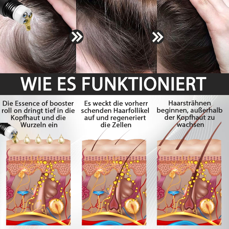 ATTDX™ Alopecia Wiederherstellungs Haar Booster Roll-On