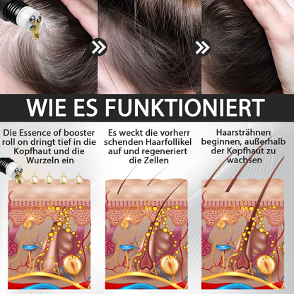 ATTDX™ Alopecia Wiederherstellungs Haar Booster Roll-On