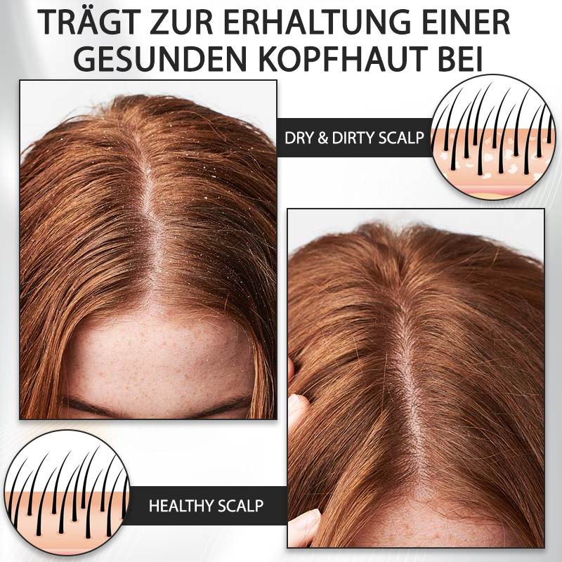 ATTDX™ Alopecia Wiederherstellungs Haar Booster Roll-On