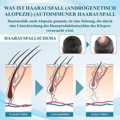 ATTDX™  Alopecia Wiederherstellungs Haarwuchscreme