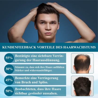 ATTDX™  Alopecia Wiederherstellungs Haarwuchscreme