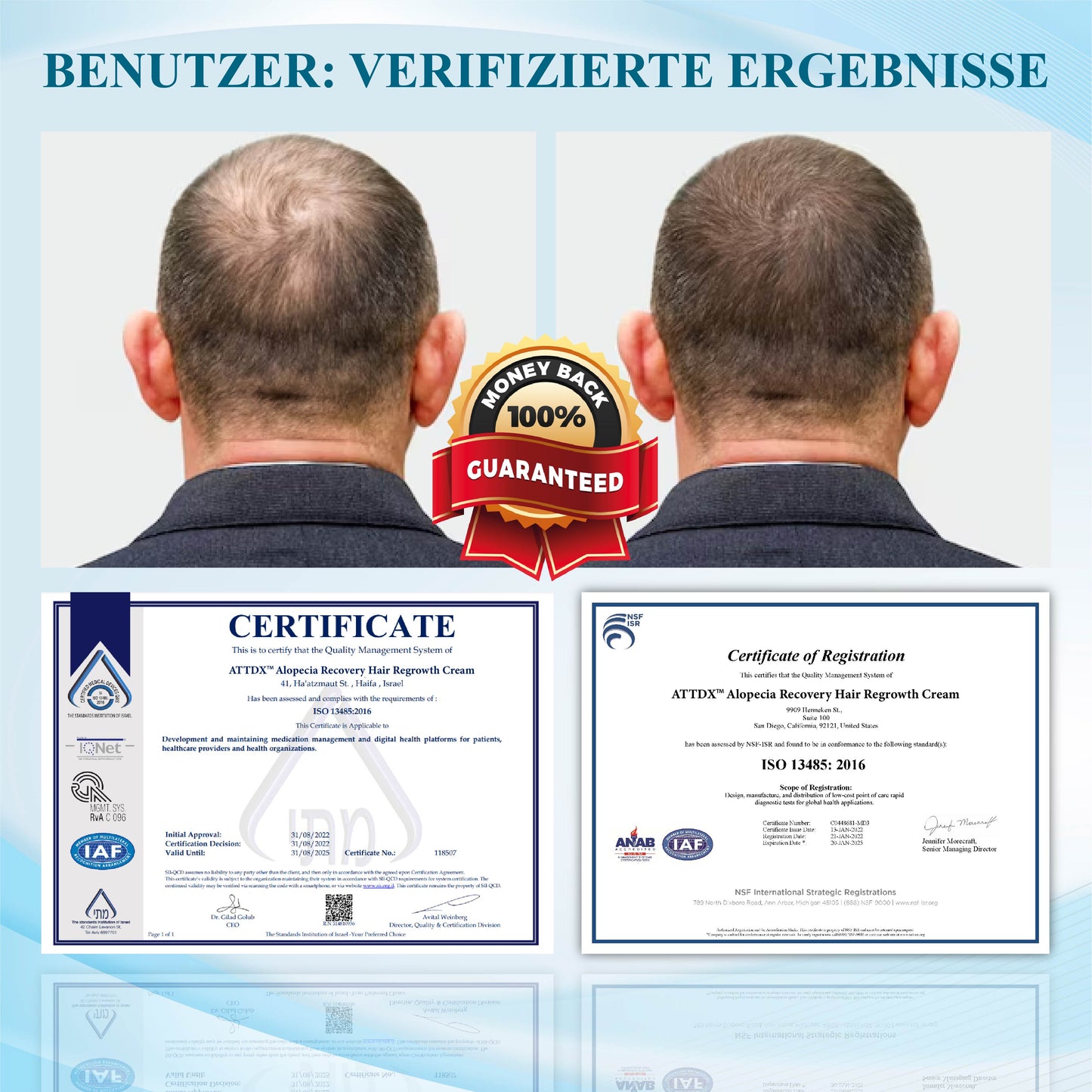 ATTDX™  Alopecia Wiederherstellungs Haarwuchscreme