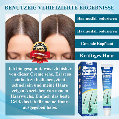 ATTDX™  Alopecia Wiederherstellungs Haarwuchscreme