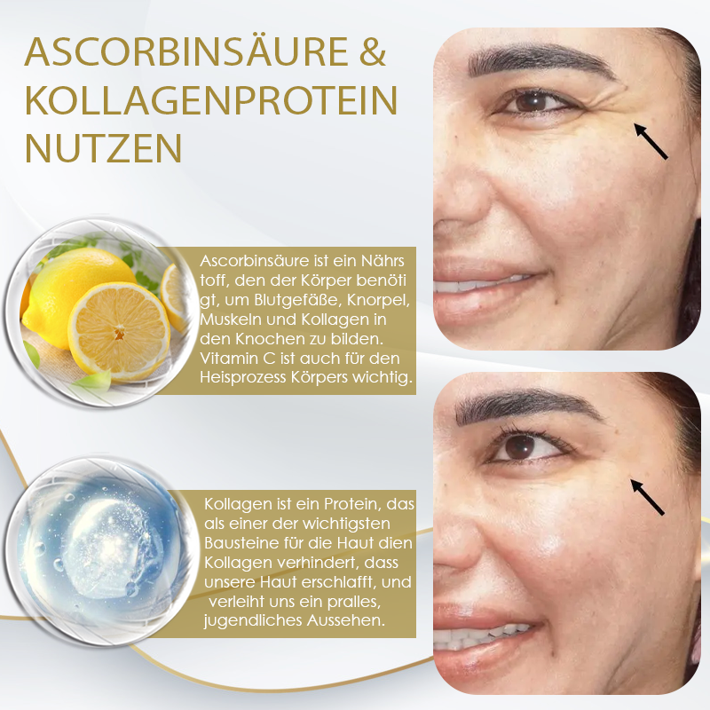 ATTDX™ BotoxLift Fortgeschrittene Straffende Creme