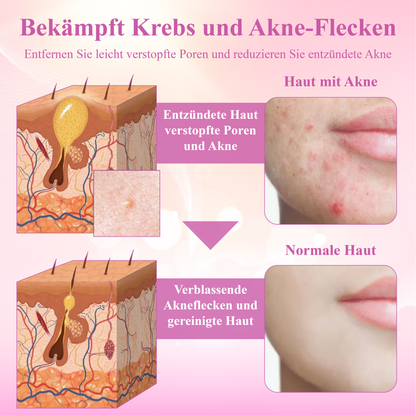 ATTDX™ Derma Relief Hauttherapie Creme