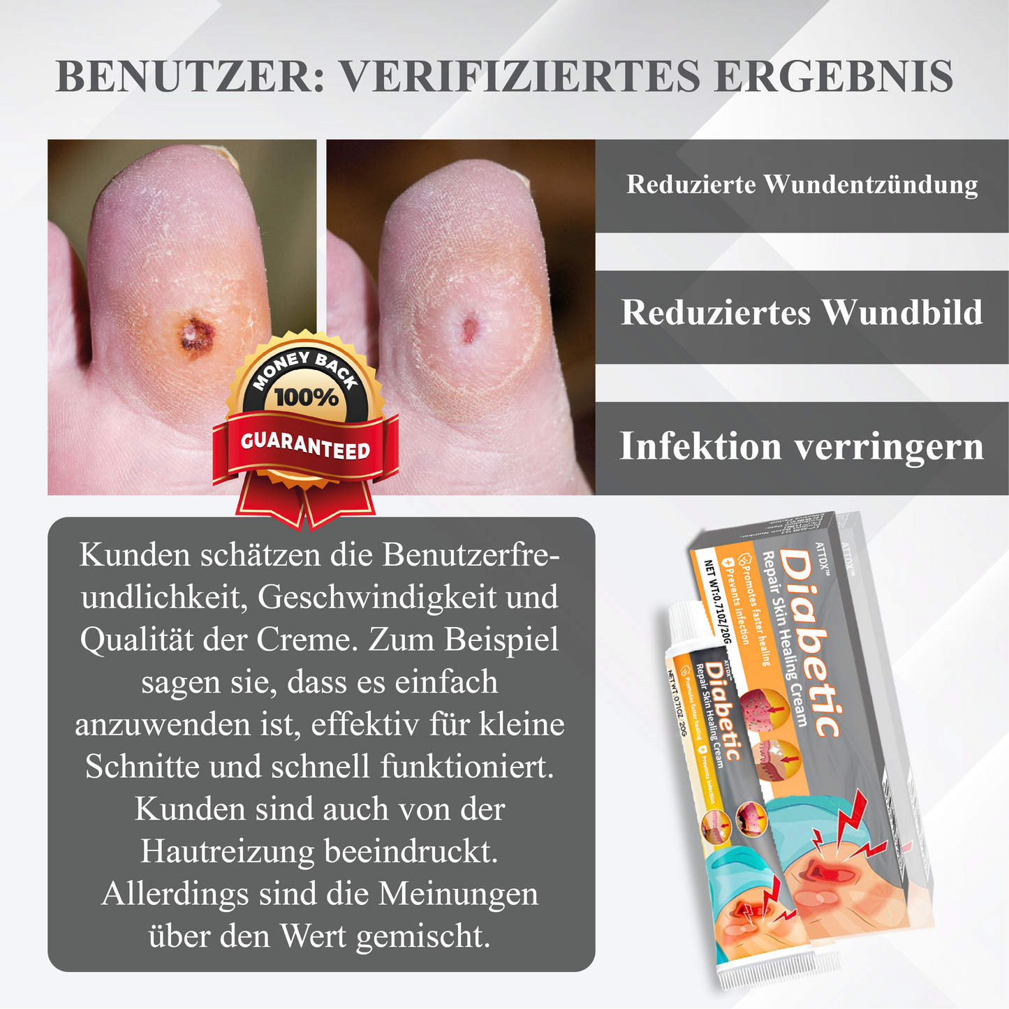 ATTDX™ Diabetische Reparatur Hautheilcreme