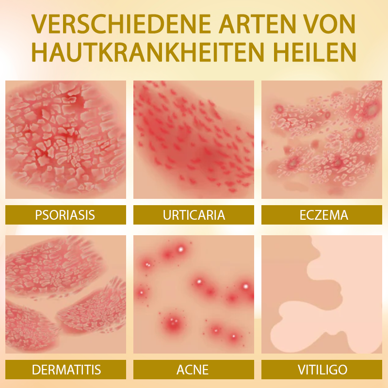 ATTDX™ Granulierte Calendula Kurkuma Hautpflege Seife