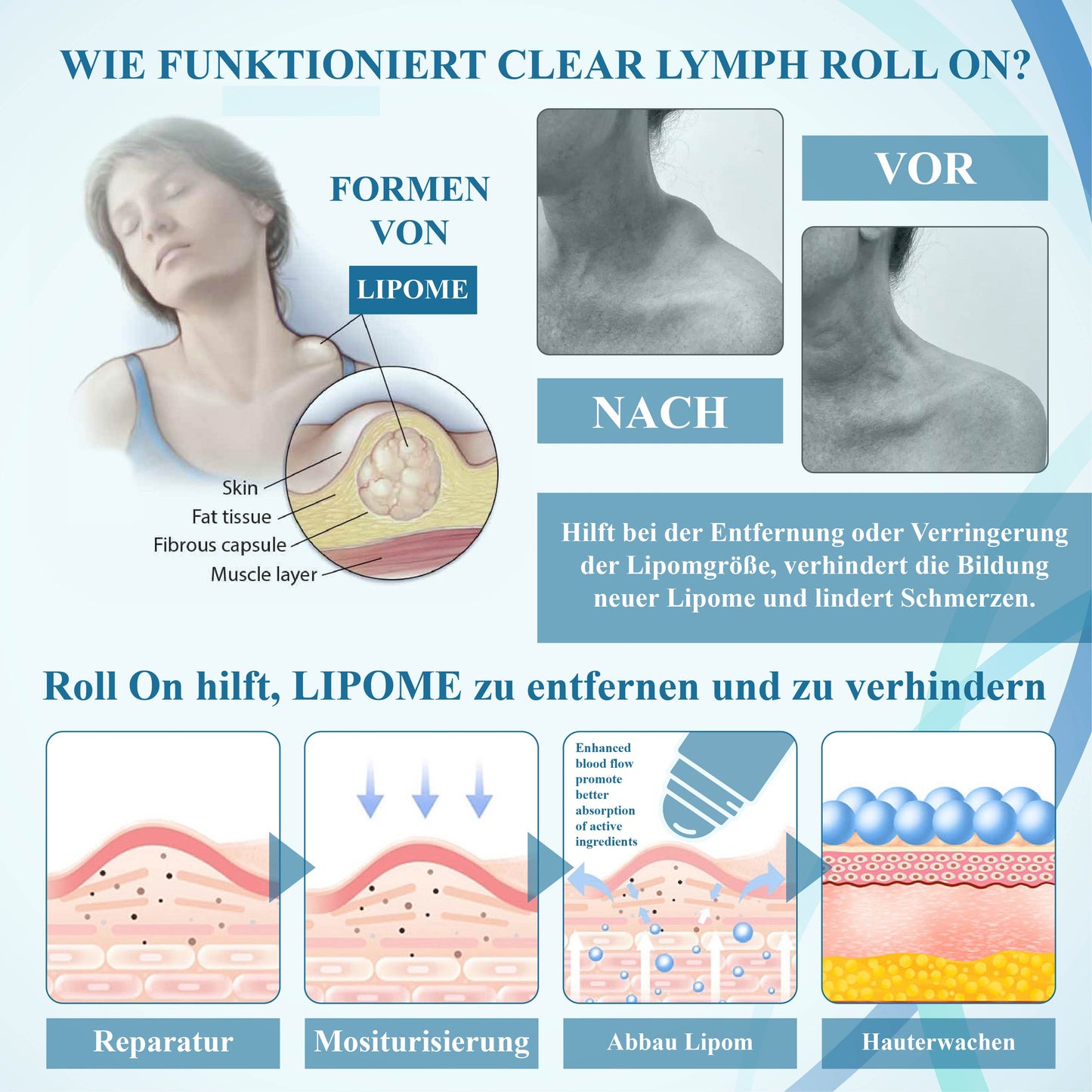 ATTDX™ LumpenKlar Lymphunterstützungs Roll-On