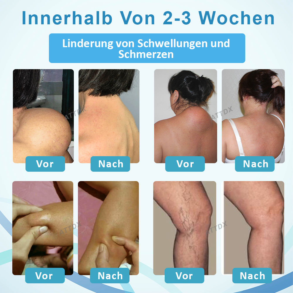 ATTDX™ LumpenKlar Lymphunterstützungs Roll-On