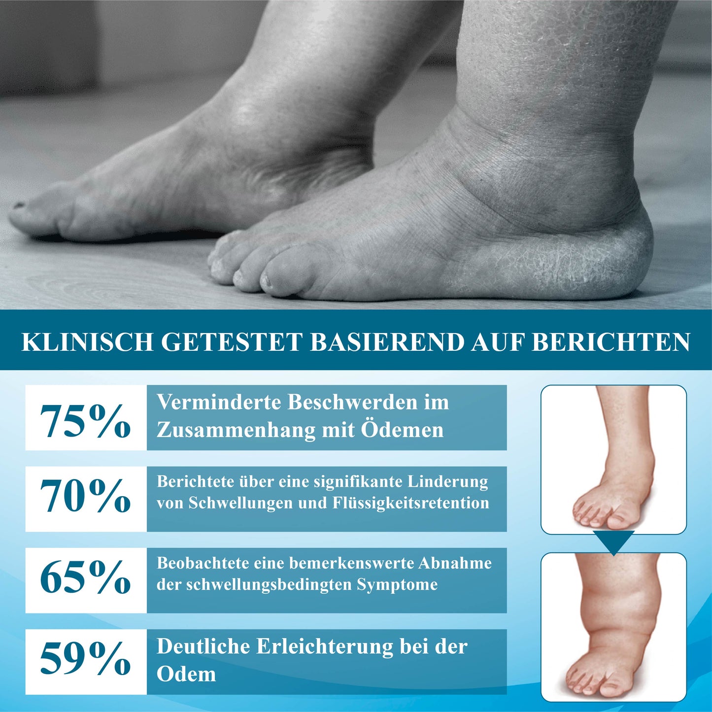 ATTDX™ SchwellungsLinderung Lymphdrainage Massagecreme