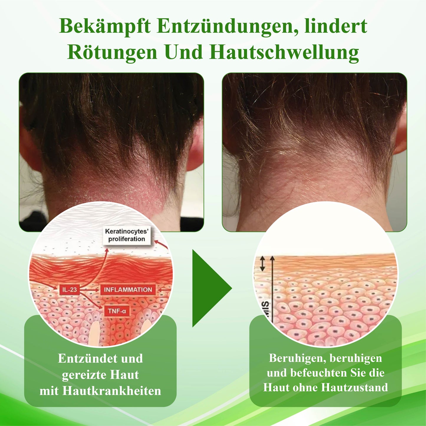 ATTDX™ Wiederauferstehungsgras Hautberuhigende