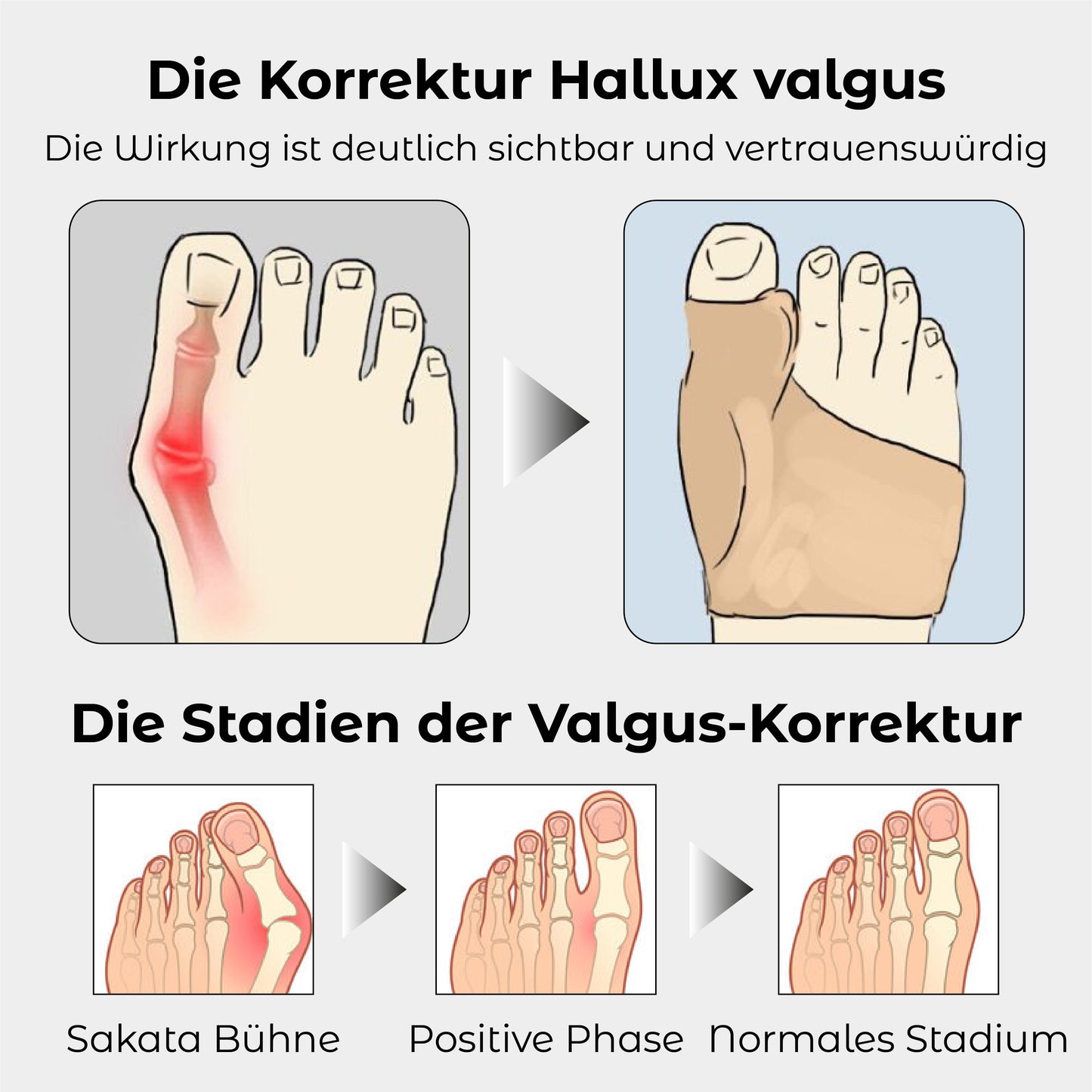 RICPIND Hallux Harmonie Korrekturgurt mit Schutzärmeln