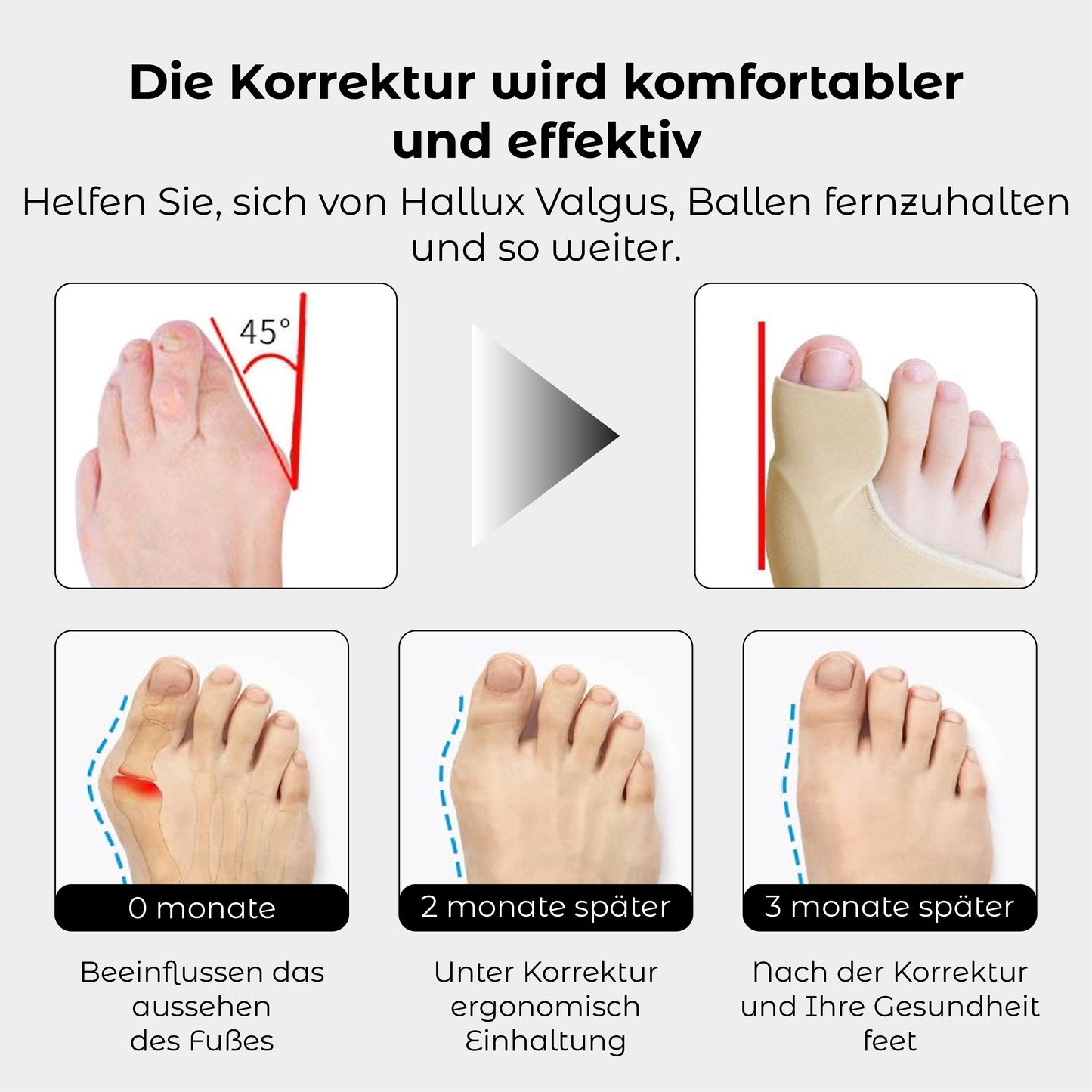 RICPIND Hallux Harmonie Korrekturgurt mit Schutzärmeln