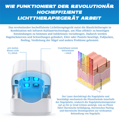 RICPIND LichtTherapie Nägel erneuern ProGerät