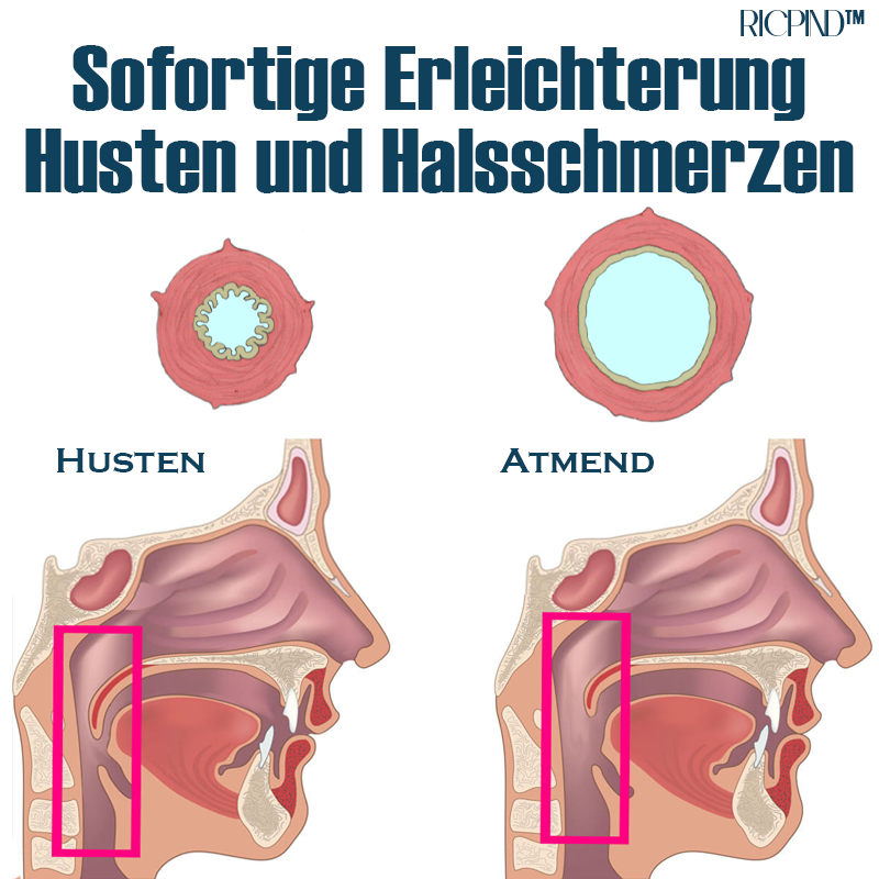 RICPIND Luftröhre Leichtigkeit SonicLight Therapie Beruhigend Instrument