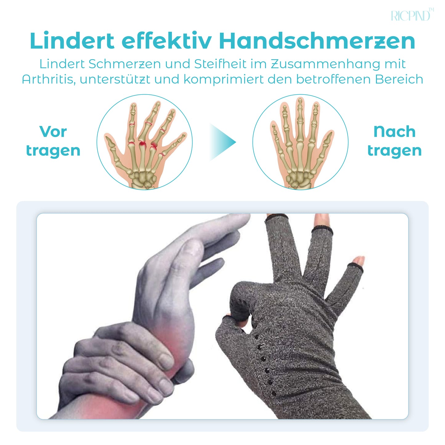 RICPIND Nervenentlastung Karpaltunnel Anti-Arthritis Kompression Fingerlose Handschuhe