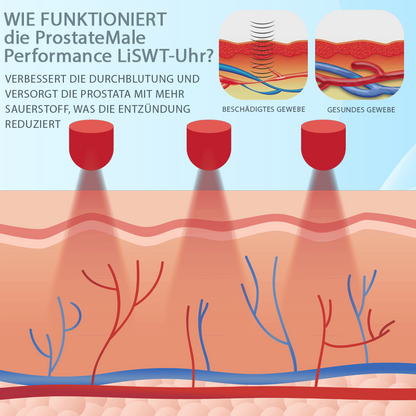 RICPIND™ ProstataMännliche Leistung LiSWT Uhr