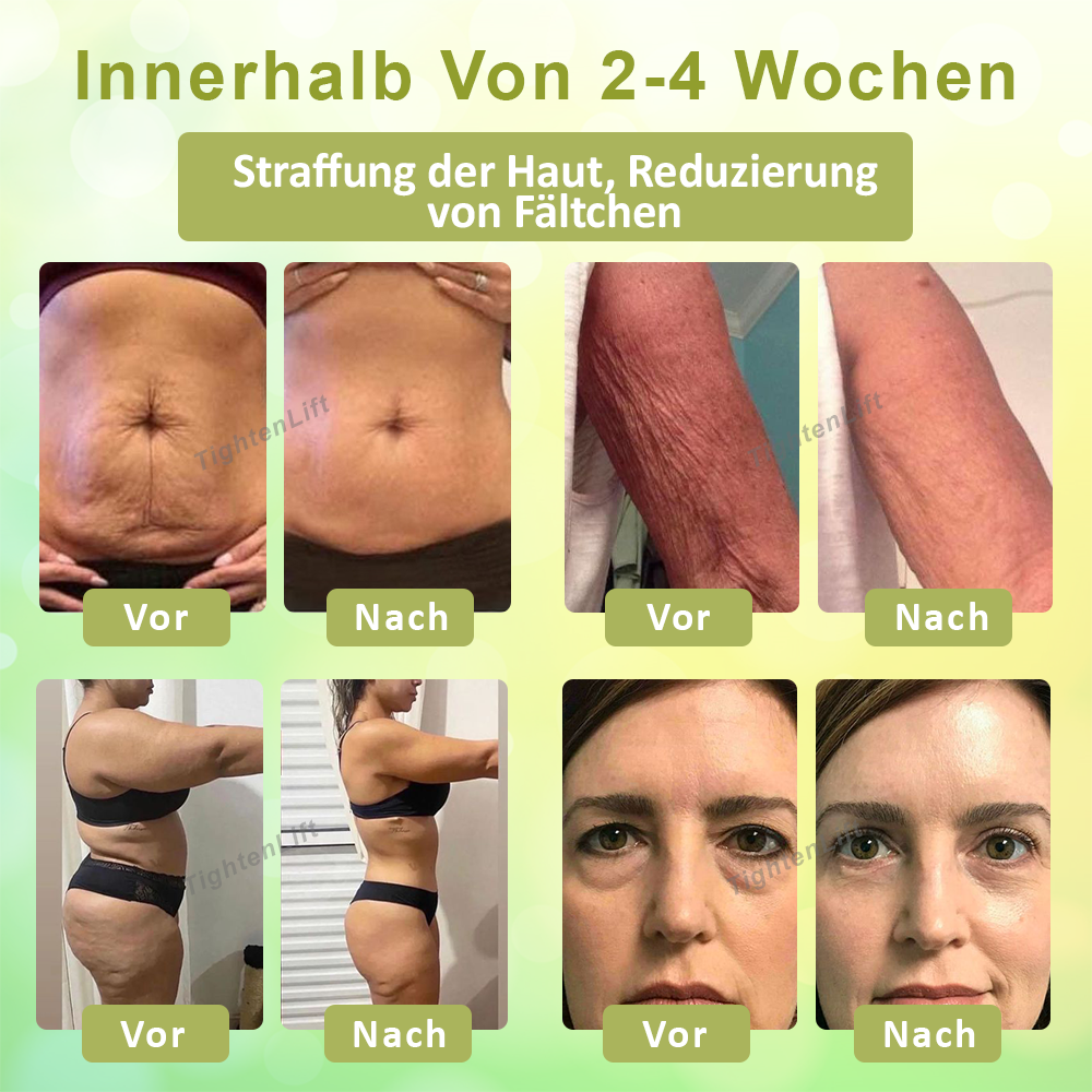 TightenLift™ Kollagen Booster Hautstraffungscreme