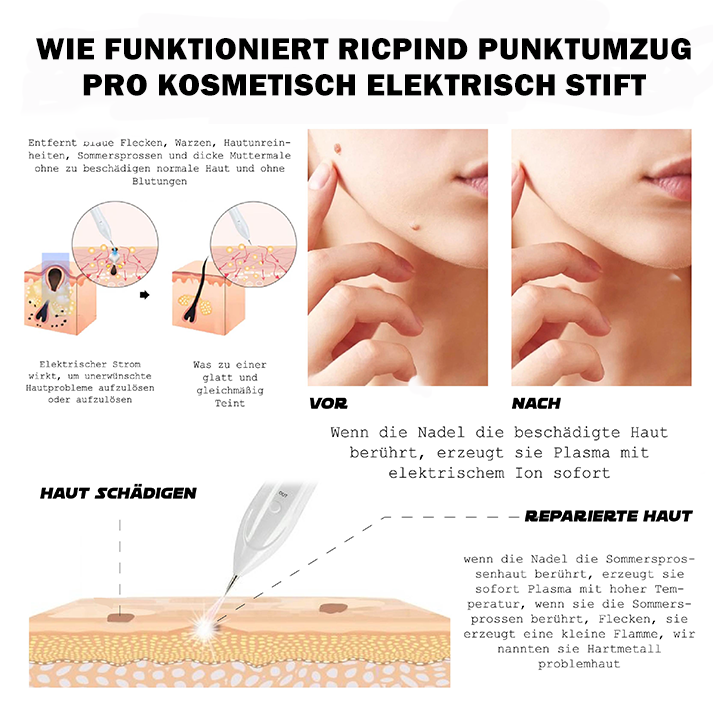 RICPIND PunktUmzug Pro Kosmetisch Elektrisch Stift