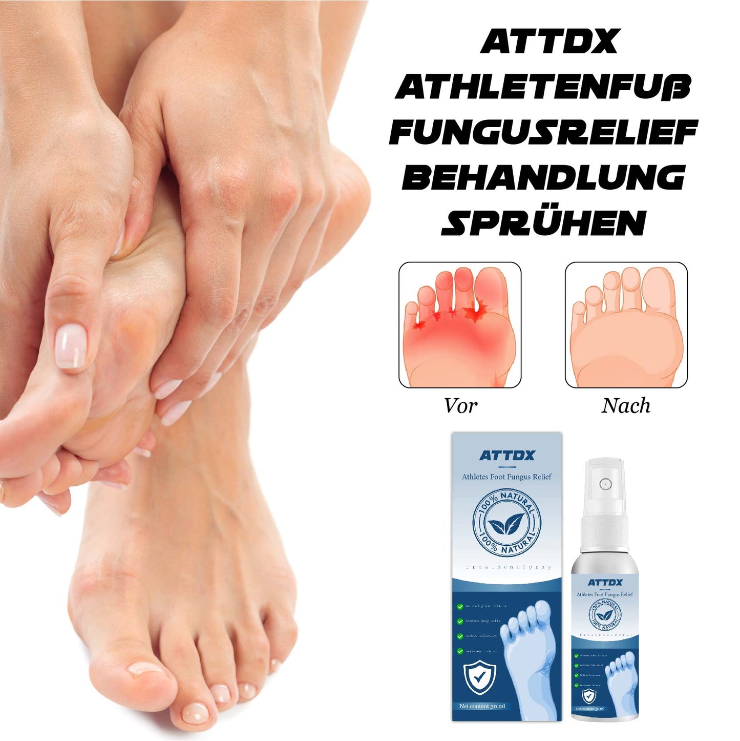 ATTDX AthletenFuß FungusRelief BehandlungSprühen