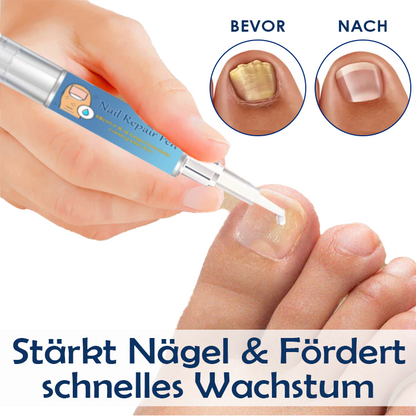 ATTDX Nagel Reparatur Fungus Behandlung Stift