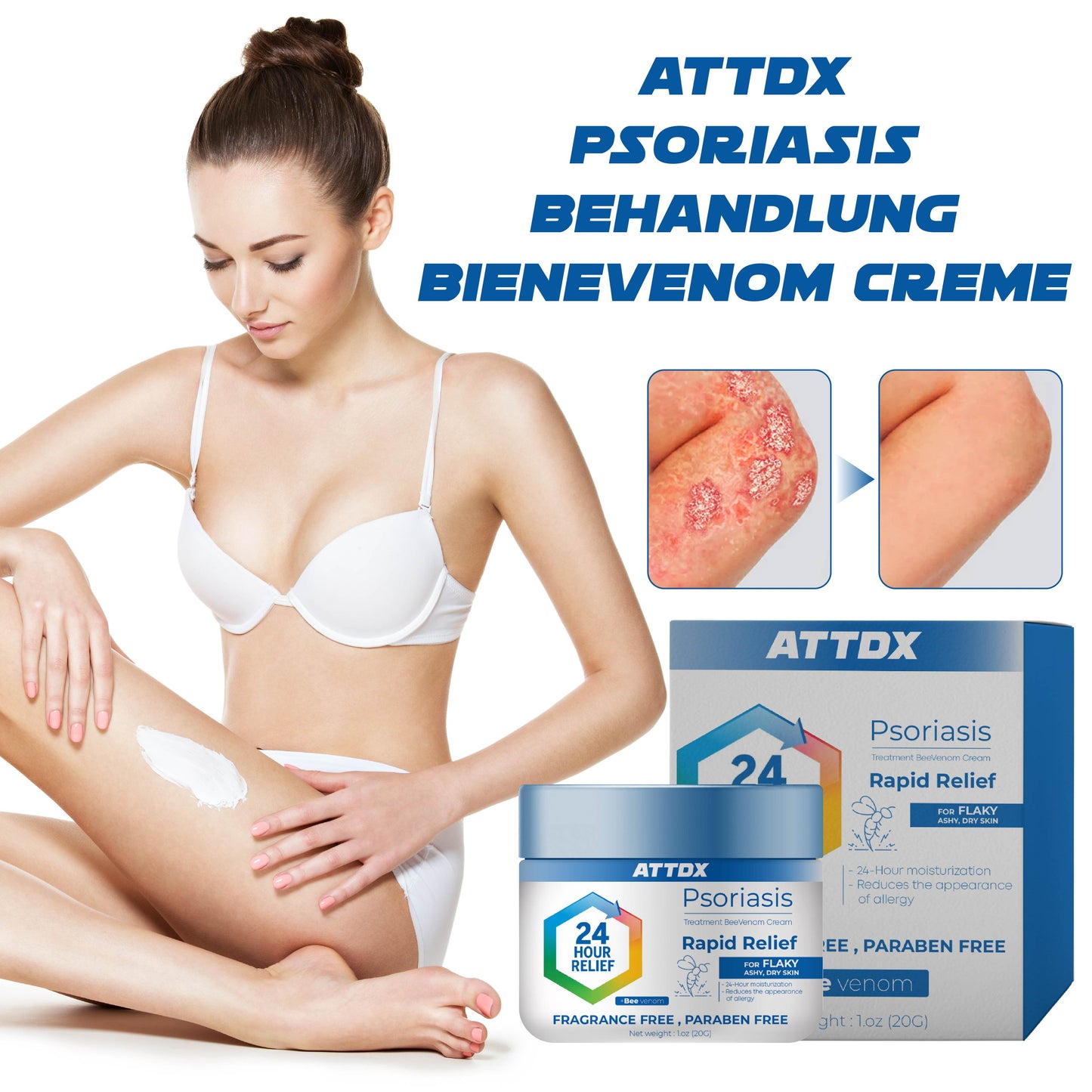 ATTDX Psoriasis Behandlung BieneVenom Creme