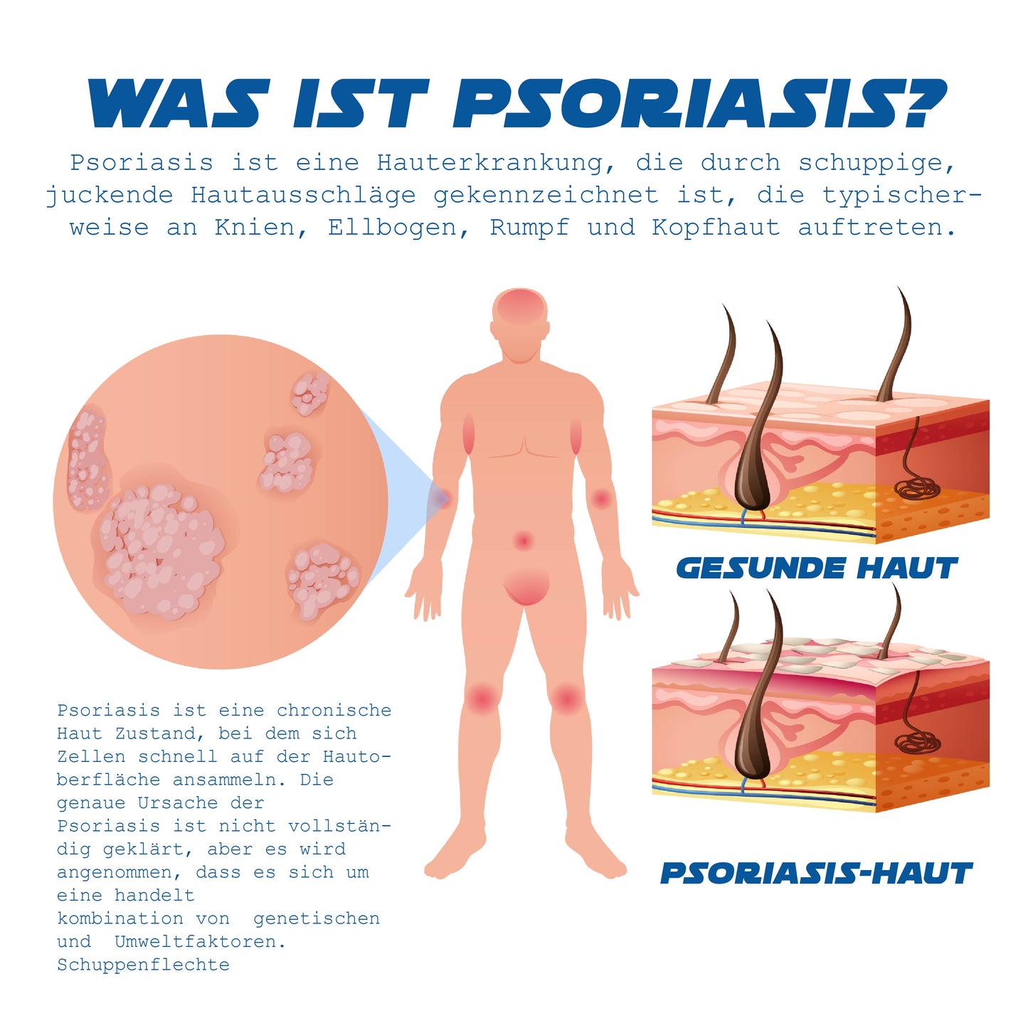 ATTDX Psoriasis Behandlung BieneVenom Creme