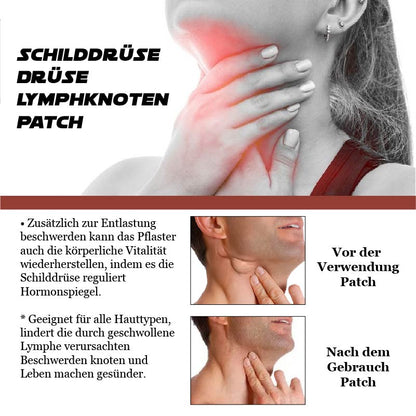 ATTDX Schilddrüse Lymphknoten Entwässerung Pflaster