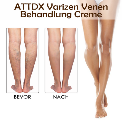 ATTDX Varizen Venen Behandlung Creme