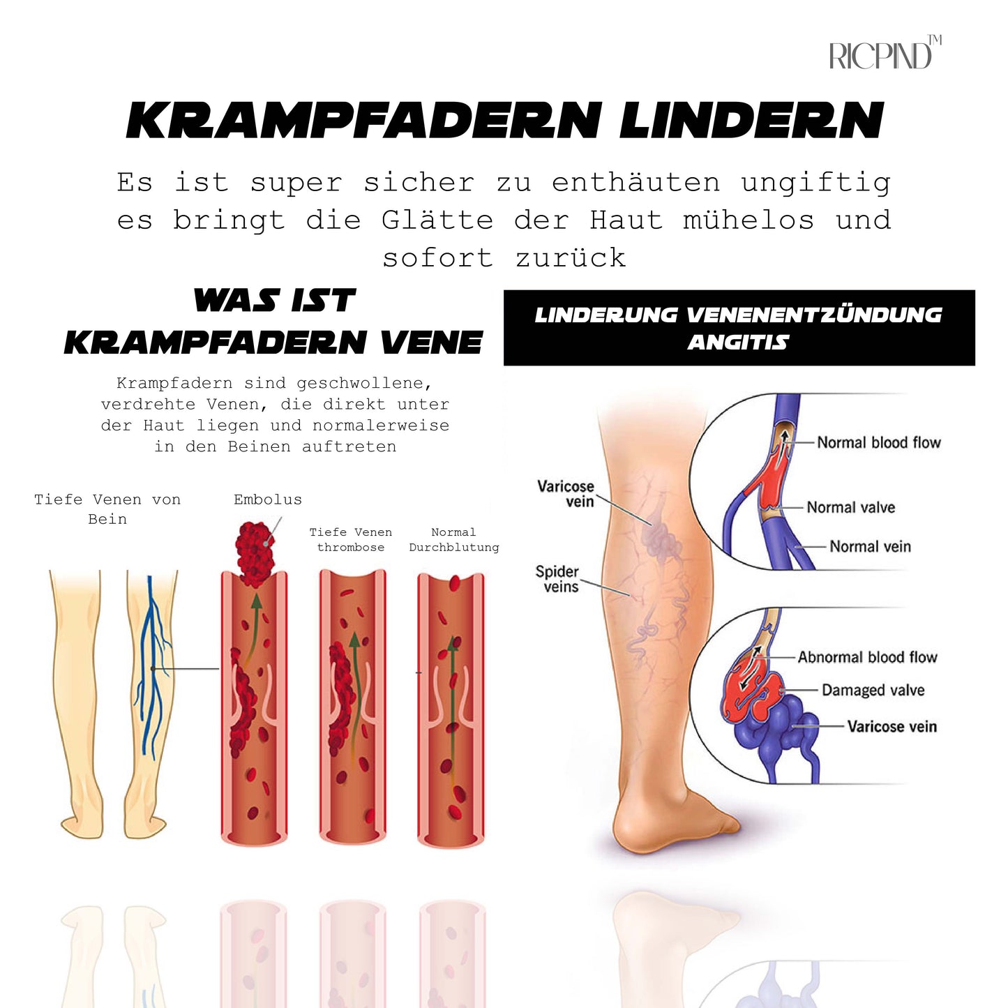 RICPIND AntiÖdeme ThermaEntspannen Komprimierung Socken