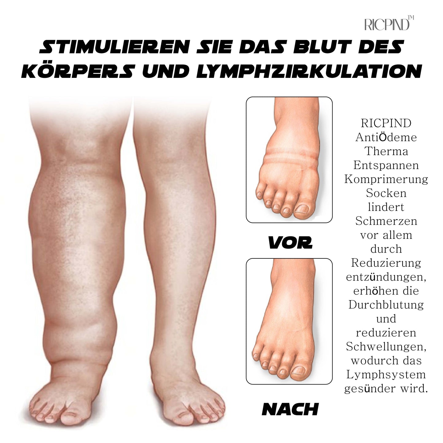 RICPIND AntiÖdeme ThermaEntspannen Komprimierung Socken