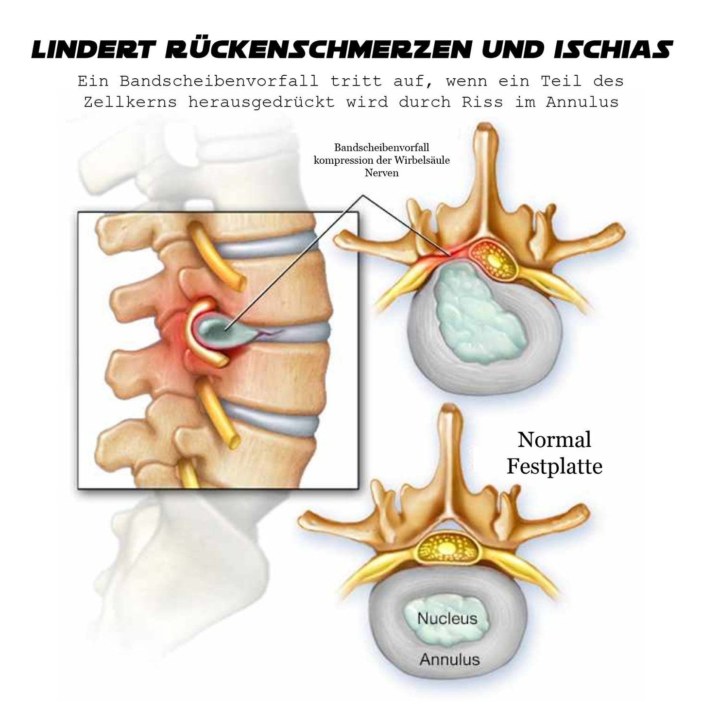 Ricpind EMS IschiasReliever Therapeutisch Massagegerät