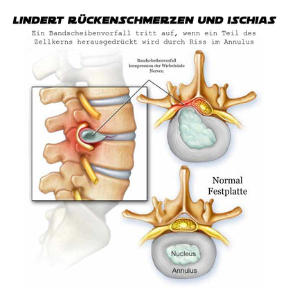 Ricpind EMS IschiasReliever Therapeutisch Massagegerät