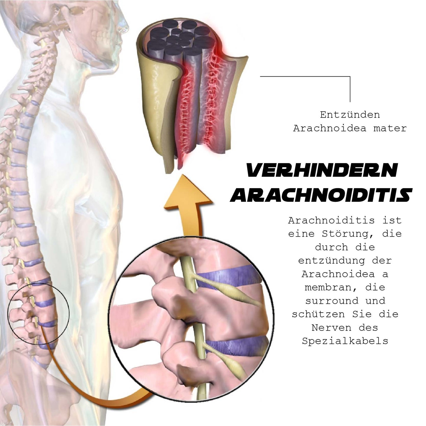 Ricpind EMS IschiasReliever Therapeutisch Massagegerät