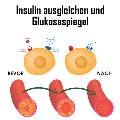 Ricpind ErleichterungZuckerkrankheit KörperBildhauerei HandRiemen