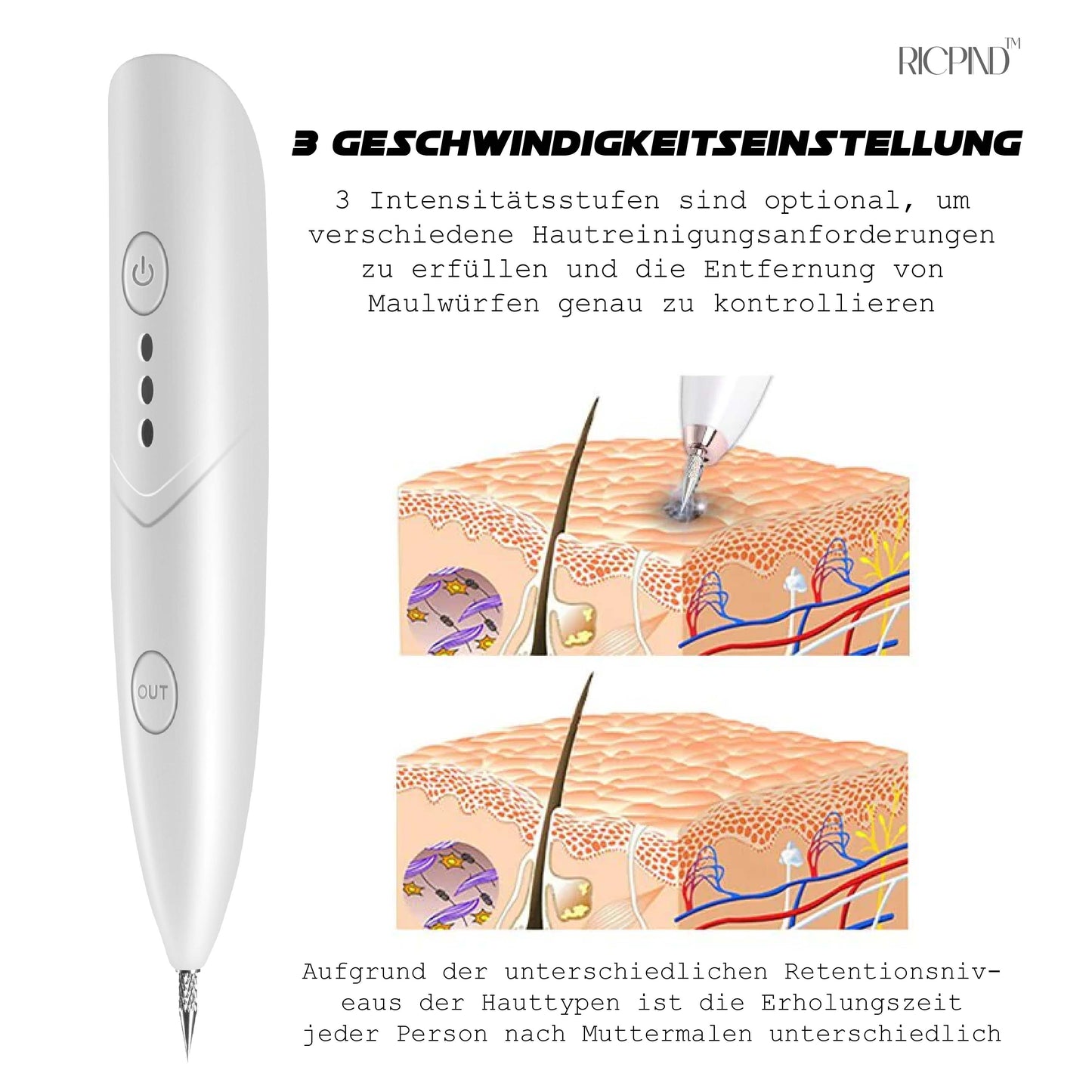 Ricpind Sofort PunktUmzug Kosmetisch Elektrisch Stift