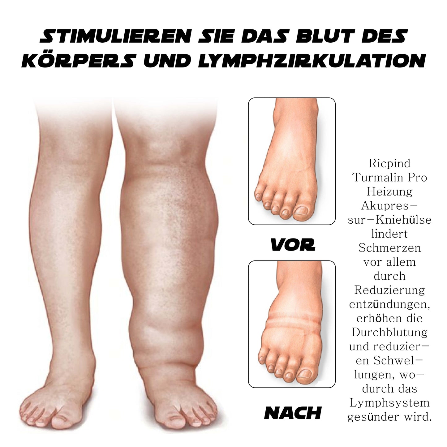 Ricpind TurmalinPro HeatingAcupressure Knieschutzhülse