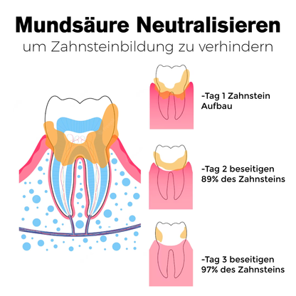 ATTDX ZähneReparieren Fleckenentferner Ampulle